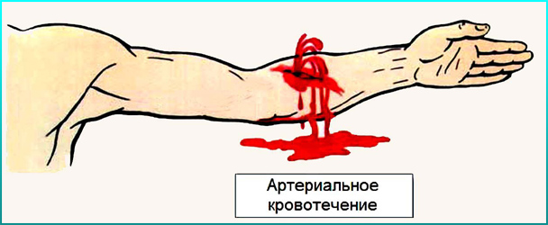 http://03chel.ru/images/firstaidrazlkrov/1.png