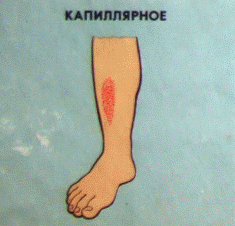 http://900igr.net/datai/obg/Pervaja-pomosch-pri-krovotechenijakh/0003-001-Obschij-obem-tsirkulirujuschej-krovi-v-organizme-vzroslogo-cheloveka.png